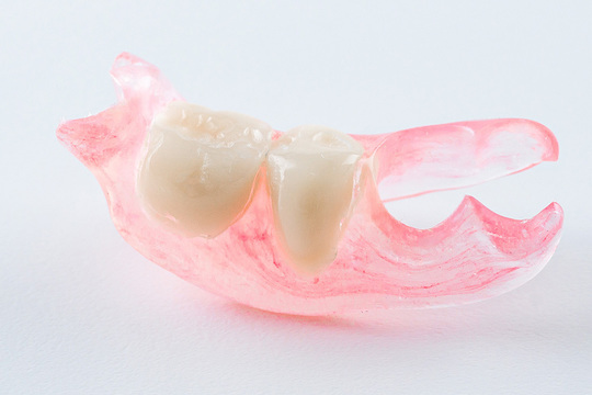 入れ歯（義歯）の治療 - 北川歯科医院（大津市・膳所）